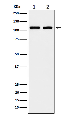 1 - Anti-eIF3B Rabbit Monoclonal Antibody ABO15947