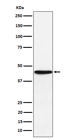 1 - Anti-HLA F Rabbit Monoclonal Antibody ABO15949