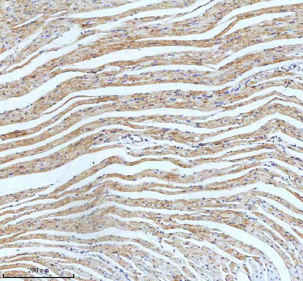 2 - Anti-ECM1 Rabbit Monoclonal Antibody ABO15951