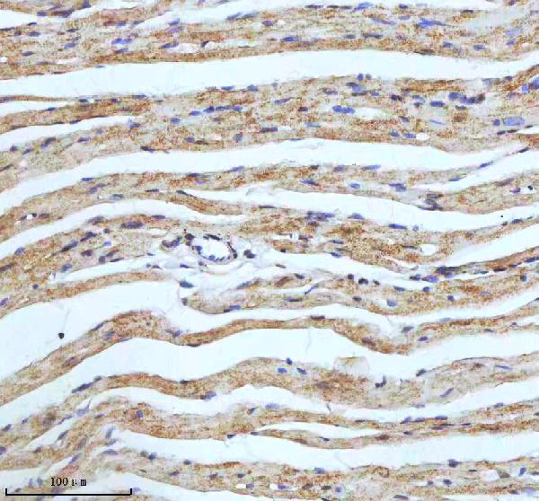 2 - Anti-ECM1 Rabbit Monoclonal Antibody ABO15951