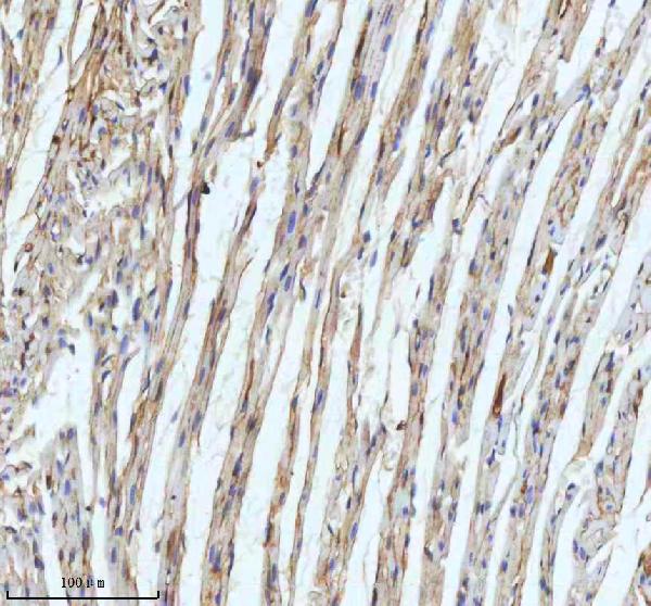 2 - Anti-ECM1 Rabbit Monoclonal Antibody ABO15951