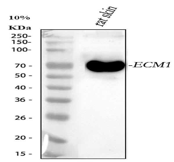 1 - Anti-ECM1 Rabbit Monoclonal Antibody ABO15951