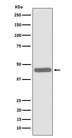 1 - Anti-ALKBH1 Rabbit Monoclonal Antibody ABO15952