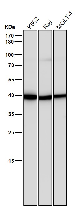1 - Anti-ALKBH1 Rabbit Monoclonal Antibody ABO15952