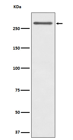 1 - Anti-CD35 Rabbit Monoclonal Antibody ABO15953