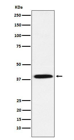 1 - Anti-Phospho-IKB alpha (S36) Rabbit Monoclonal Antibody ABO15954