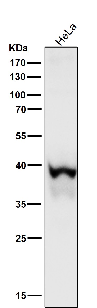 1 - Anti-Phospho-IKB alpha (S36) Rabbit Monoclonal Antibody ABO15954