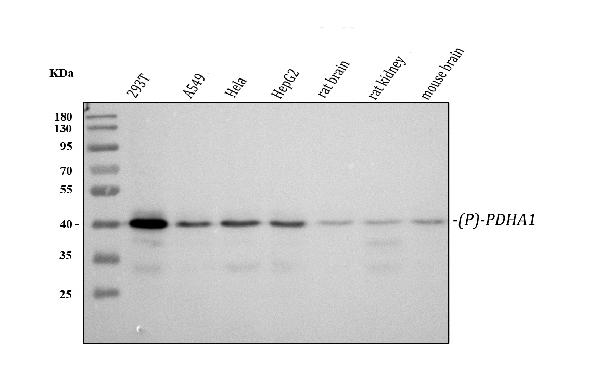 1 - Anti-Phospho-PDHA1 (S293) Rabbit Monoclonal Antibody ABO15955