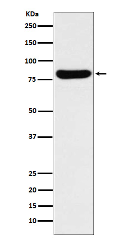 1 - Anti-GUSB Rabbit Monoclonal Antibody ABO15956