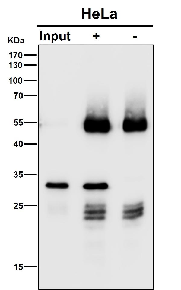 1 - Anti-CHMP2B Rabbit Monoclonal Antibody ABO15957
