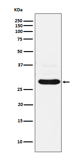1 - Anti-CHMP2B Rabbit Monoclonal Antibody ABO15957