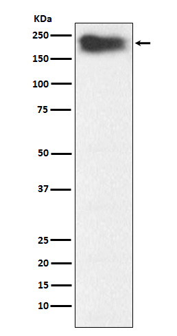 1 - Anti-MYH7B Rabbit Monoclonal Antibody ABO15959