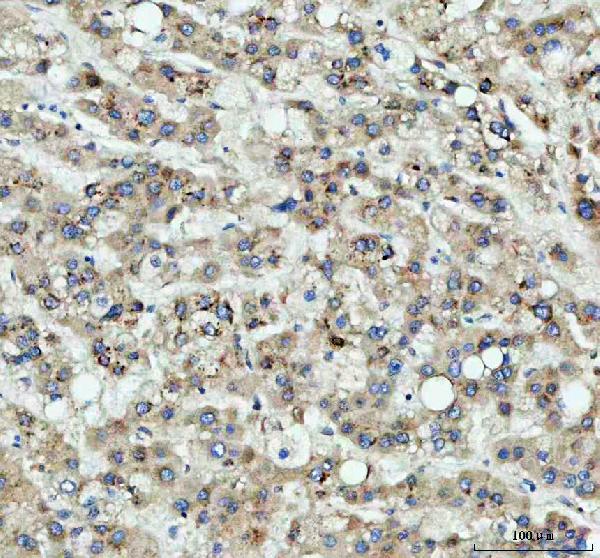 2 - Anti-RPL7A Rabbit Monoclonal Antibody ABO15960