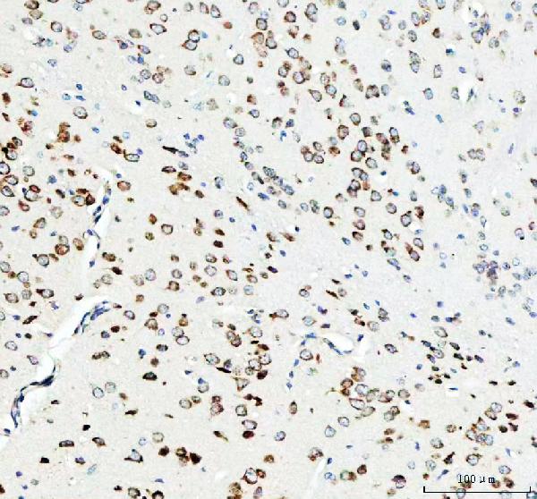 2 - Anti-RPL7A Rabbit Monoclonal Antibody ABO15960