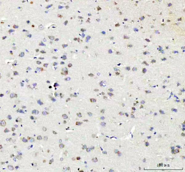 2 - Anti-RPL7A Rabbit Monoclonal Antibody ABO15960