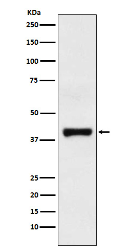 1 - Anti-GOT2 Rabbit Monoclonal Antibody ABO15961