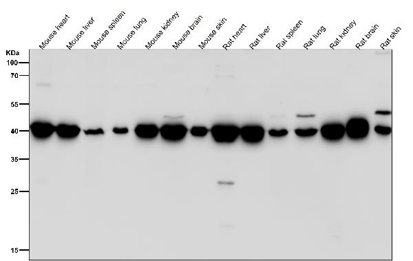 1 - Anti-GOT2 Rabbit Monoclonal Antibody ABO15961