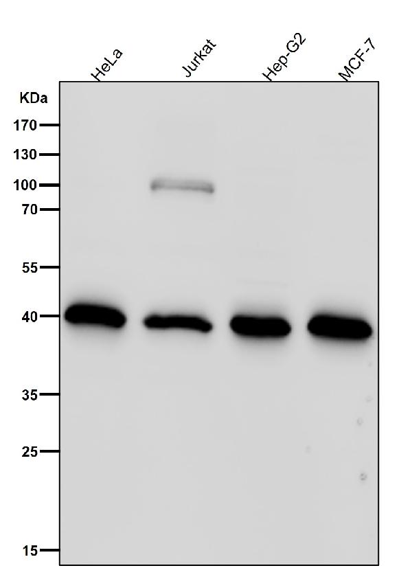 1 - Anti-GOT2 Rabbit Monoclonal Antibody ABO15961