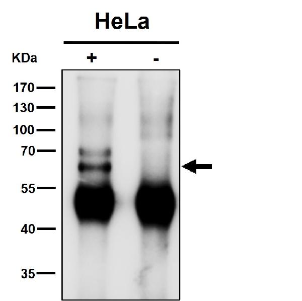 1 - Anti-KLC1 Rabbit Monoclonal Antibody ABO15962