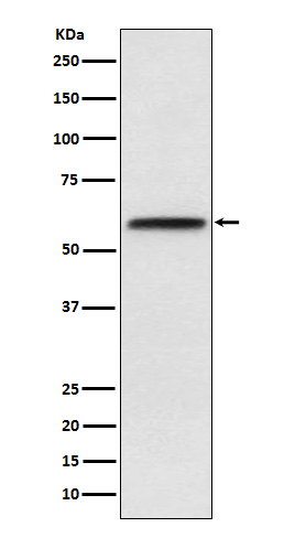 1 - Anti-LCAT Rabbit Monoclonal Antibody ABO15963