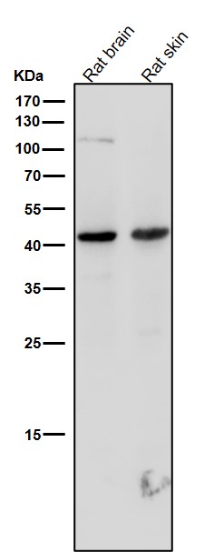 1 - Anti-TROY Rabbit Monoclonal Antibody ABO15964