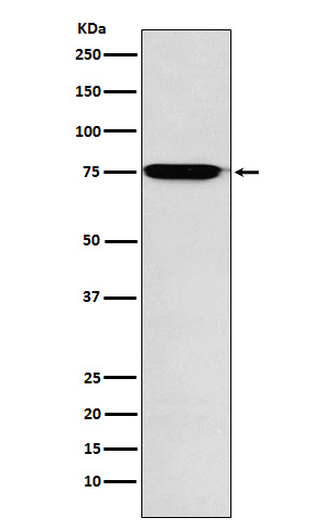 1 - Anti-GAA Rabbit Monoclonal Antibody ABO15967