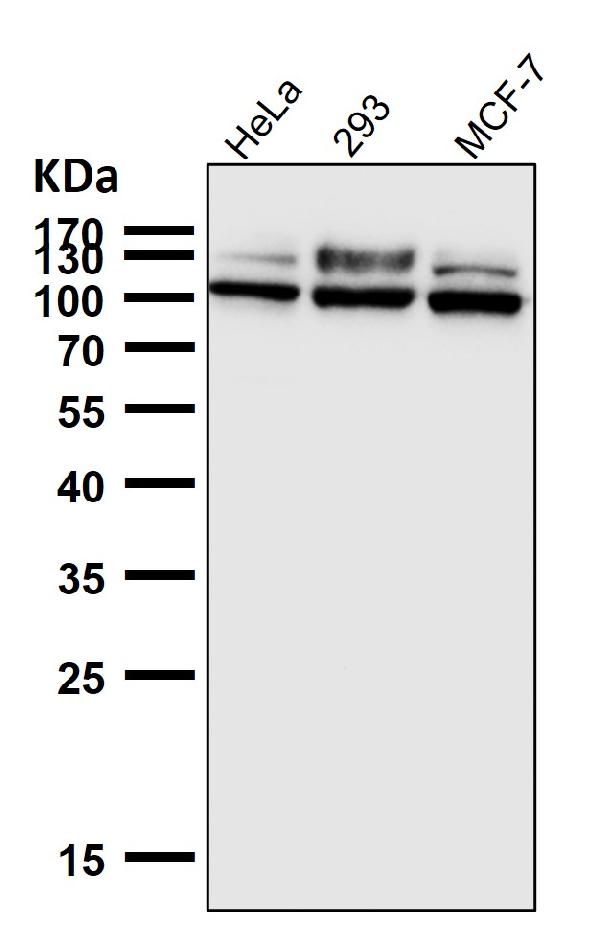 1 - Anti-GAA Rabbit Monoclonal Antibody ABO15967