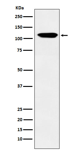 1 - Anti-Eph receptor B3 Rabbit Monoclonal Antibody ABO15970