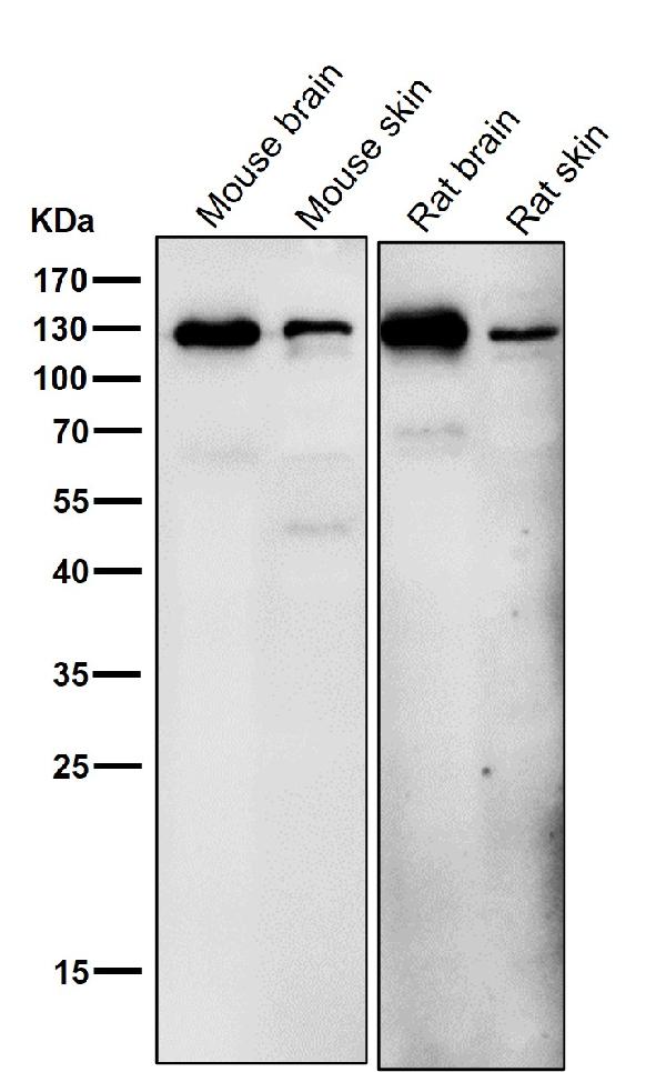 1 - Anti-Eph receptor B3 Rabbit Monoclonal Antibody ABO15970