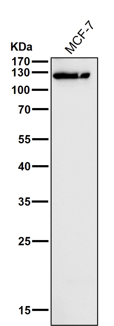 1 - Anti-Eph receptor B3 Rabbit Monoclonal Antibody ABO15970