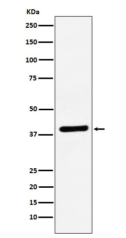 1 - Anti-VEGFD Rabbit Monoclonal Antibody ABO15971