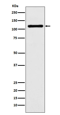 1 - Anti-DPYD Rabbit Monoclonal Antibody ABO15973