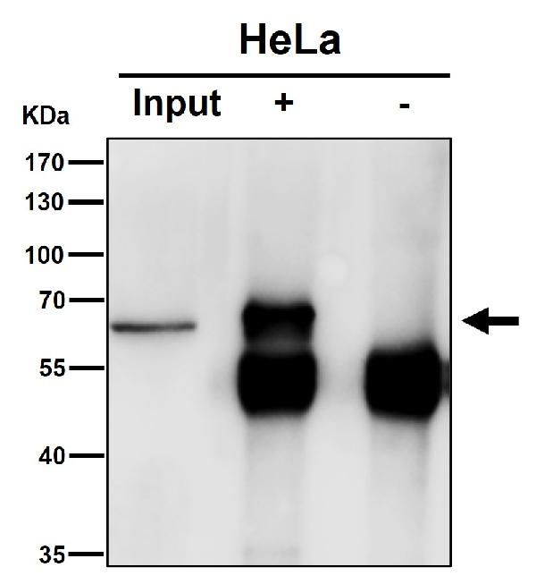 1 - Anti-Lgi1 Rabbit Monoclonal Antibody ABO15976