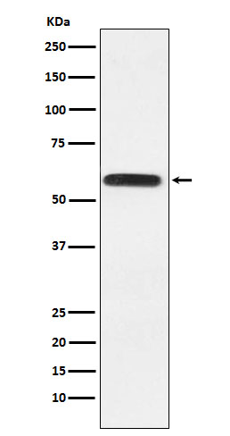 1 - Anti-Lgi1 Rabbit Monoclonal Antibody ABO15976