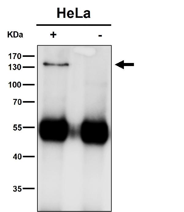 1 - Anti-HTSF1 Rabbit Monoclonal Antibody ABO15977