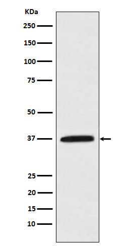 1 - Anti-Kallikrein 5 Rabbit Monoclonal Antibody ABO15980