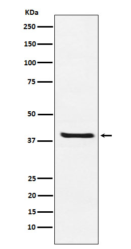 1 - Anti-Arg2 Rabbit Monoclonal Antibody ABO15981