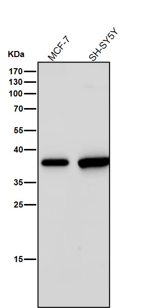 1 - Anti-Arg2 Rabbit Monoclonal Antibody ABO15981