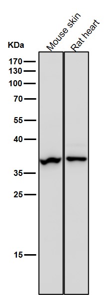 1 - Anti-Arg2 Rabbit Monoclonal Antibody ABO15981