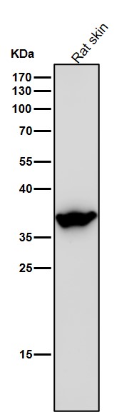 1 - Anti-Arg2 Rabbit Monoclonal Antibody ABO15981