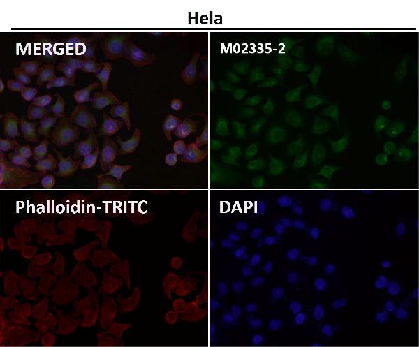 1 - Anti-P4HB Rabbit Monoclonal Antibody ABO15982