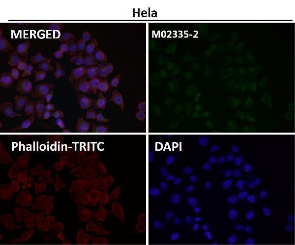 1 - Anti-P4HB Rabbit Monoclonal Antibody ABO15982