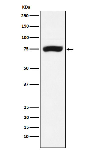 1 - Anti-XPD Rabbit Monoclonal Antibody ABO15983