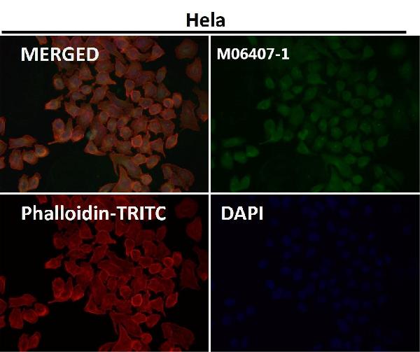1 - Anti-VPS28 Rabbit Monoclonal Antibody ABO15984