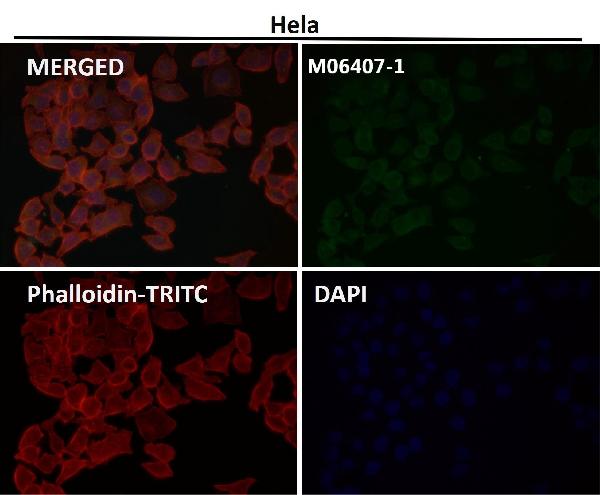 1 - Anti-VPS28 Rabbit Monoclonal Antibody ABO15984