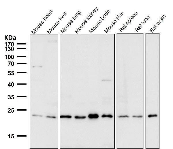 1 - Anti-VPS28 Rabbit Monoclonal Antibody ABO15984