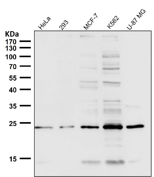 1 - Anti-VPS28 Rabbit Monoclonal Antibody ABO15984