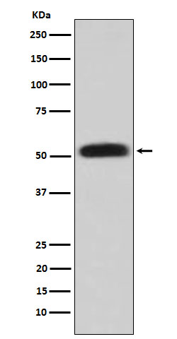 1 - Anti-Glycerol kinase Rabbit Monoclonal Antibody ABO15986