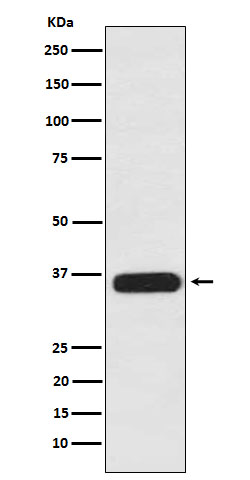 1 - Anti-PDLIM1 Rabbit Monoclonal Antibody ABO15989