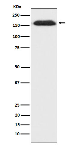 1 - Anti-SUPT5H Rabbit Monoclonal Antibody ABO15990
